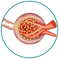 Glomerulonephritis