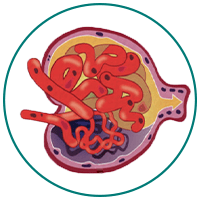 Nephrotic Syndrome