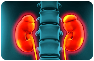 Recurrent Kidney Infections