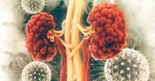 Polycystic Kidney Disease