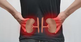 IgA Nephropathy