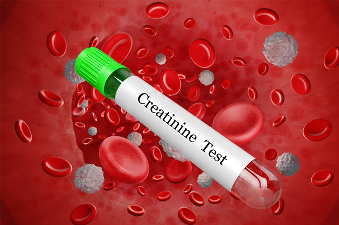 Control Creatinine Levels in Blood