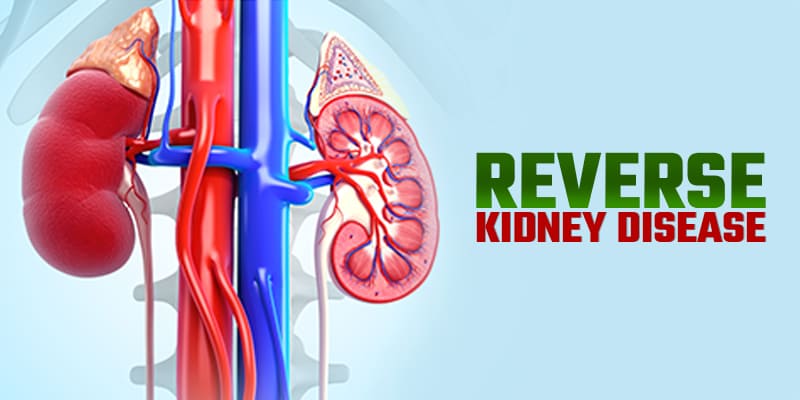 Reverse-Kidney