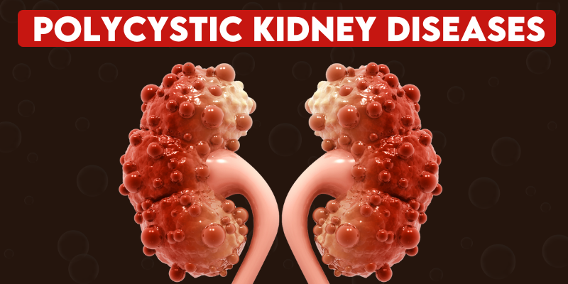 Polycystic kidney Disease 