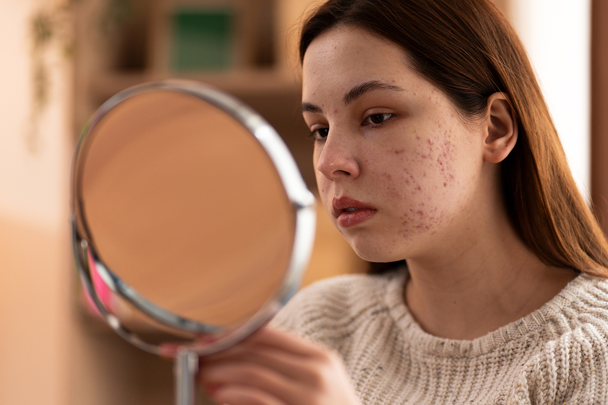 How to Treat Skin Hyperpigmentation Naturally